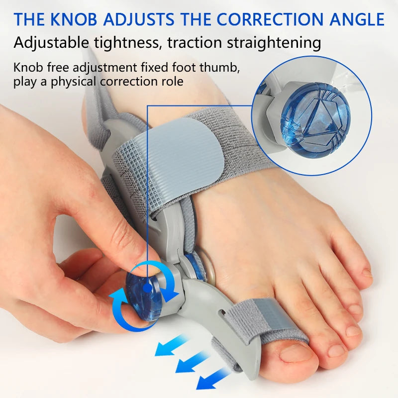 AlignLab Bunion Corrector – Rotatable Hallux Valgus Brace & Toe Straightener for Men & Women